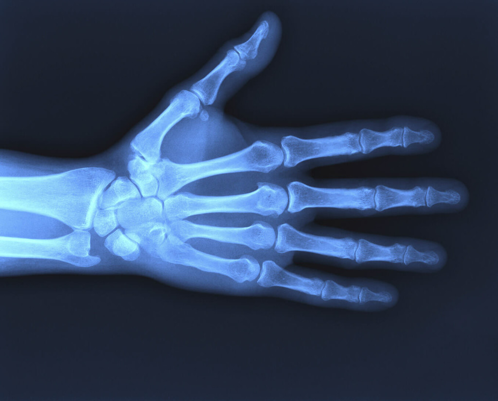 MidSouth Medical Imagingxrayhand MidSouth Medical Imaging