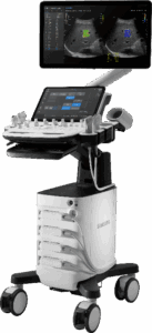 Samsung Ultrasound V5 Left half