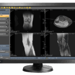 EvoView PACS on PC (1)