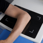 Elbow_Lateral-01-crop
